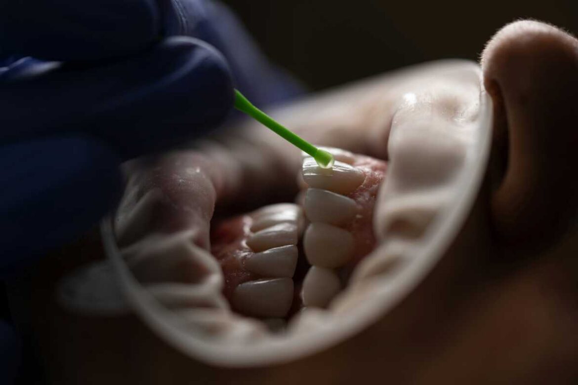 The-cost-of-tooth-extraction-and-insurance-coverage